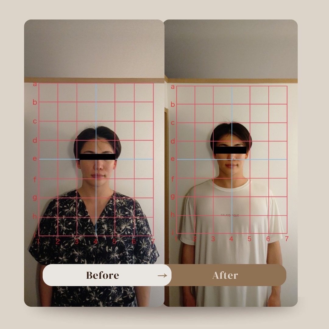 30代男性のBefore/After（施術後は中心軸でバランスが取れ肩の高さが揃う）